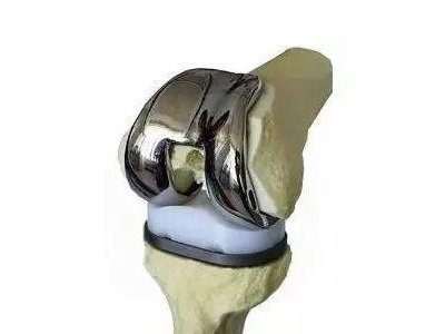 ɹ^eP(gun)(ji)ÓQut(y)Ժɹ_չ˹մg(sh)