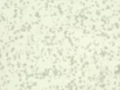 X²Ϲ̣mhµVI(y)Ƽvͨ