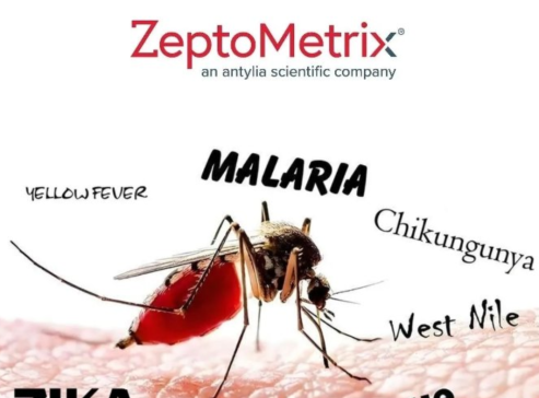 ֱ׿飺 ZeptoMetrixF؛ԭwԭc|Ʒ푑